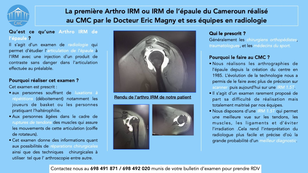 La première Arthro IRM ou IRM de l'épaule du Cameroun réalisé au CMC